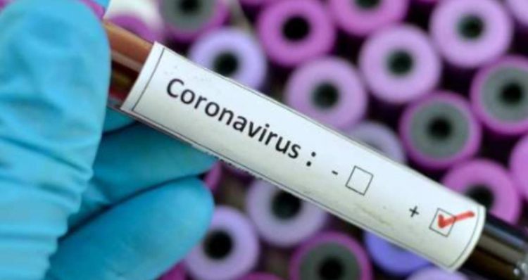 Global coronavirus COVID-19 cases cross 20 million mark, death toll above 734000